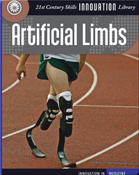 Innovation: Artificial Limbs