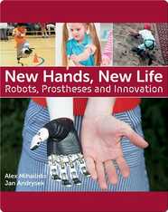 New Hands, New Life: Robots, Prostheses and Innovation