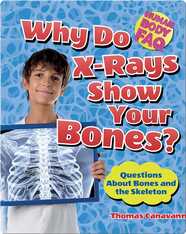 Why Do X-Rays Show Your Bones?: Questions About Bones and the Skeleton