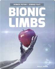 Bionic Limbs