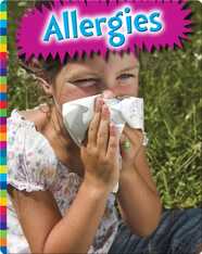 Allergies