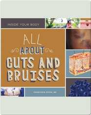 All About Cuts and Bruises