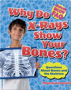 Why Do X-Rays Show Your Bones?: Questions About Bones and the Skeleton