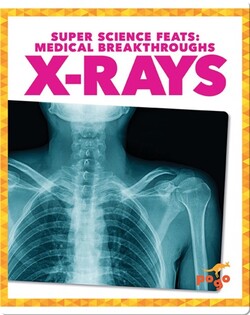 Medical Breakthroughs: X-Rays