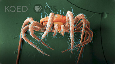 Deep Look: These Mites Rain Down To Save Your Strawberries