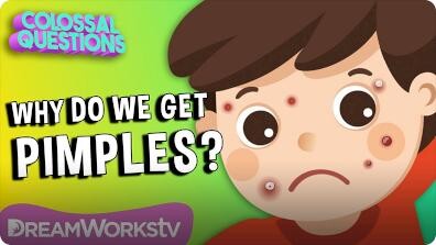 Colossal Questions: Why Do We Get Pimples?