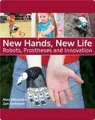 New Hands, New Life: Robots, Prostheses and Innovation