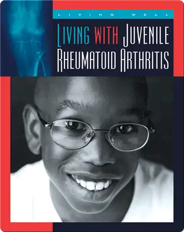 Living with Juvenile Rheumatoid Arthritis book