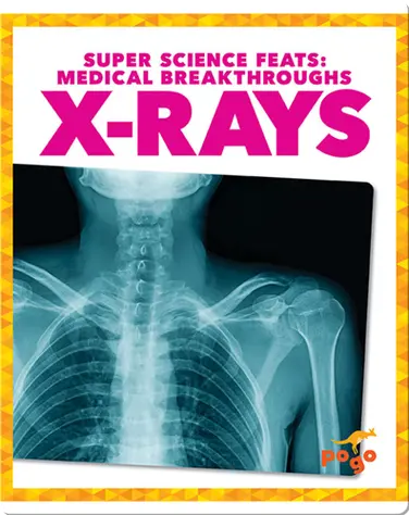 Medical Breakthroughs: X-Rays book