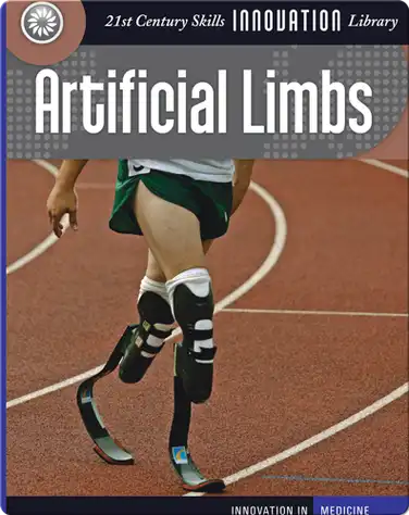 Innovation: Artificial Limbs book