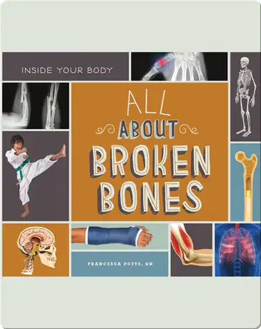 All About Broken Bones book