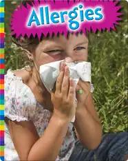 Allergies